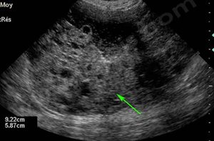 Echographie abdominale d’une tumeur de l’ovaire chez une chienne, responsable d’un hyperoestrogénisme