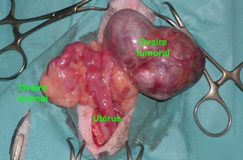 Tumeur de l’ovaire chez une chienne, responsable d’un hyperoestrogénisme, après exérèse chirurgicale