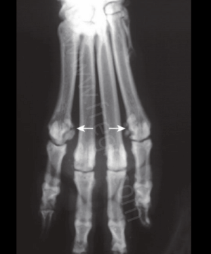 Radiographie mettant en évidence une fragmentation des os sésamoïdes chez un chien