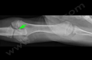 Radiographie de l’humérus d’un chiot avec une fracture de la plaque de croissance