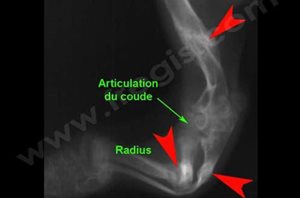 1. Radiographie de la patte avant d’un chien présentant une ostéogénèse imparfaite. L’os est anormalement « transparent » et plusieurs fractures plus ou moins consolidées sont présentes (flèches rouges).