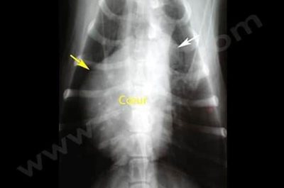 Radiographie du cœur d’un chien de race Boxer atteint d’une sténose pulmonaire. La partie droite du cœur (flèche jaune) et le tronc pulmonaire (flèche blanche) sont hypertrophiés.