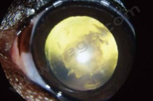 2. Cataracte congénitale (opacité blanche centrale dans le cristallin) chez un chien Cavalier King Charles Spaniel. Dans ce cas, un lenticône postérieur était associé (non visible sur cette photo).