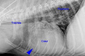 2.Radiographie des poumons d’un chien Westy