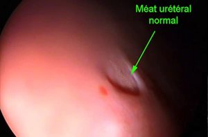 Cystoscopie chez un chien souffrant d’hématurie idiopathique rénale. abouchement de l’uretère du côté normal