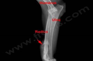 1. Ostéosarcome du radius chez un chien
