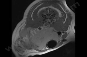 IRM du cou d’un chien Golden retriever avec une volumineuse tumeur infiltrante de la thyroïde (coupe transversale)