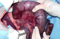2. Vue chirurgicale chez un Berger Allemand atteint de volvulus intestinal. Noter la dilatation majeure et la couleur anormale des anses de l’intestin (dévascularisation)