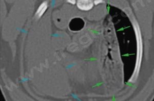 Scanner réalisé sur un animal présentant une torsion bilatérale de lobe pulmonaire