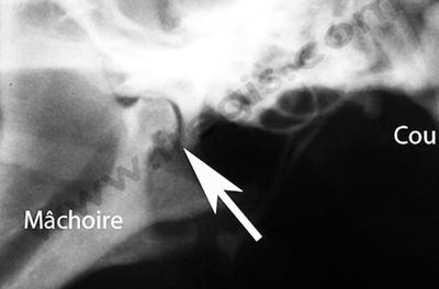 Radiographie de l’articulation de la mâchoire chez un chien de race Labrador atteint d’une dysplasie temporo-mandibulaire