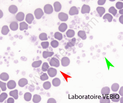 Les plaquettes sanguines, ou thrombocytes (flèche verte) sont des éléments du sang qui interviennent dans la coagulation du sang (flèche rouge : globules rouges).