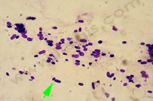 Dermatite à Malassezia chez le chat. Vue au microscope de la levure (photo D Héripret)