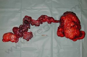 2. Enorme tumeur testiculaire intra-abdominale chez un chien cryptorchide non opéré à son jeune âge
