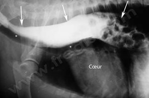 1. Radiographie du thorax d’un chien atteint d’un megaœsophage.