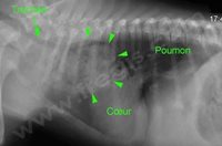 1. Radiographie du thorax d’un chien atteint d’une persistance du 4ème arc aortique droit. En avant du cœur, l’œsophage est anormalement dilaté (jabot œsophagien délimité par les flèches) et rempli d’aliments.