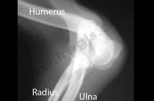 Chien de race Yorkshire terrier présentant une luxation congénitale du coude de type 2. Radiographie de profil du coude. C’est une forme moins grave que le type I