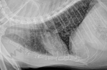 1. Radiographie thoracique latérale montrant des anomalies bronchiques et péribronchiques importantes