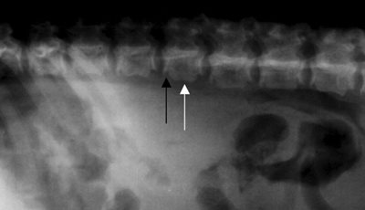 Mucopolysaccaridose,ici chez un chien avec de graves anomalies squelettiques : corps vertébraux de petite taille (flèche blanche) et irrégularités des épiphyses (flèche noire). (d’après Silverstein DC)