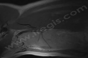 IRM du cou d’un chien Golden retriever avec une volumineuse tumeur infiltrante de la thyroïde (coupe sagittale)