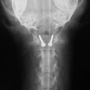 2. Radiographie de face de l’articulation atlanto-occipitale d’un chien atteint d’instabilité atlanto-axiale, après traitement chirurgical