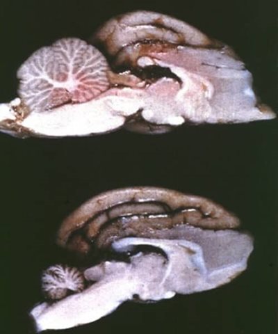 Hypoplasie cérébelleuse chez un chaton atteint de panleucopénie féline (image du bas). (©Diane Addie)