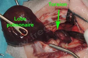 2. Image per-opératoire d’un chien opéré d’une torsion de lobe pulmonaire. La vrille au niveau du pédicule bronchique et vasculaire est bien visible, et le lobe pulmonaire est anormalement congestionné