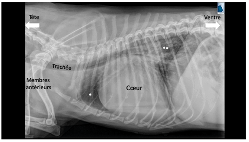 Radiographie du thorax chez un Cavalier King Charles en oedème pulmonaire. Le chien est couché sur le côté. Le coeur est très gros, signe d’une maladie cardiaque. On peut également voir une partie des poumons normaux (*), apparaissant en noir sur l’image et des poumons contenant de l’eau (**) apparaissant en blanc