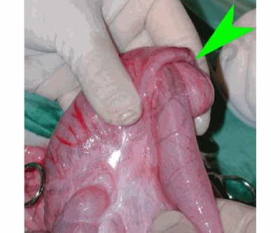 Chirurgie sur une invagination intestinale chez un chien