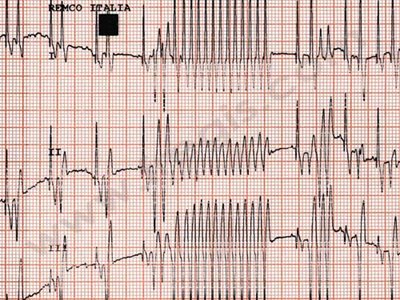 electrocardiogramme d'un chien cardique