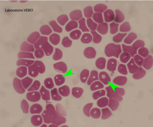 La piroplasmose (ou babésiose) est une maladie parasitaire du chien due à des protozoaires (Babesia canis) que l’on trouve dans les globules rouges (flèches vertes).