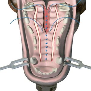 Schéma illustrant une technique de chirurgie pour traiter une fente palatine chez le chien