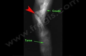 2. Radiographie de la patte avant d’un chien présentant une ostéogénèse imparfaite. L’os est anormalement « transparent » et plusieurs fractures plus ou moins consolidées sont présentes (flèches rouges).