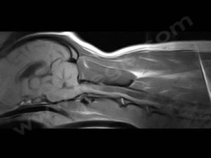 IRM d’un chien Cavalier King Charles atteint d’un syndrome de Chiari 