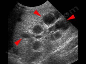 Echographie des reins d’un chat Persan atteint de polykystose rénale (PKD)