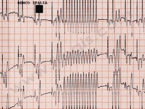 Mon chien fait une crise cardiaque