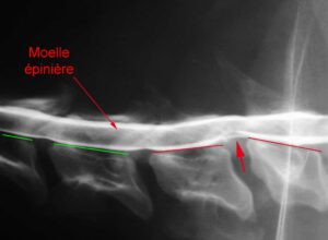 Myélographie sur un Boerboel atteint d'un syndrome de wobbler