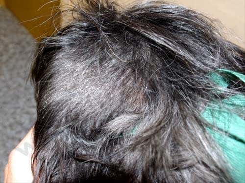 L’alopecia areata chez le chien
