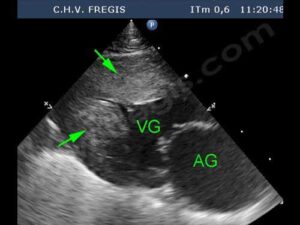 Cardiomyopathie hypertrophique chez le Sphynx