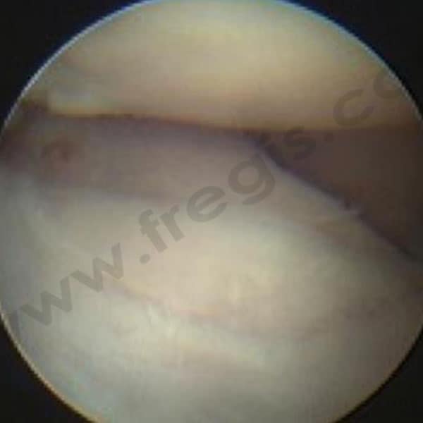 Arthroscopie du coude chez le chien