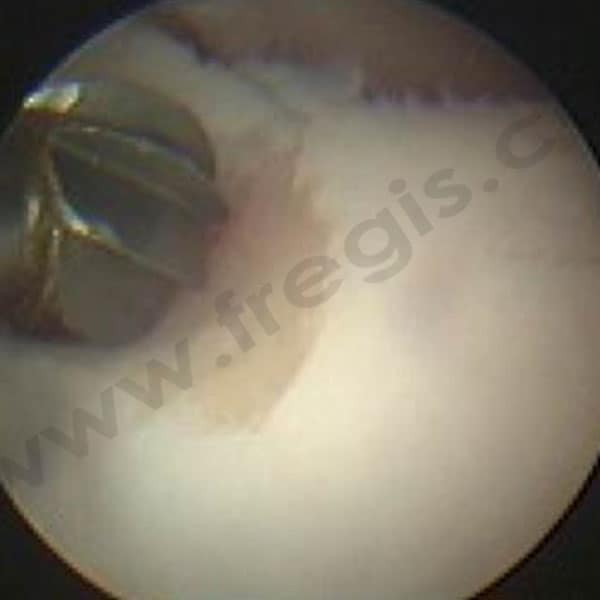 Arthroscopie du coude chez le chien