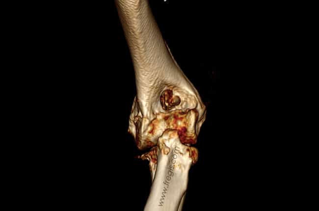 Arthrose chez le chien