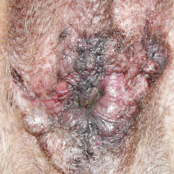 Fistules périanales (furonculose anale) chez le chien