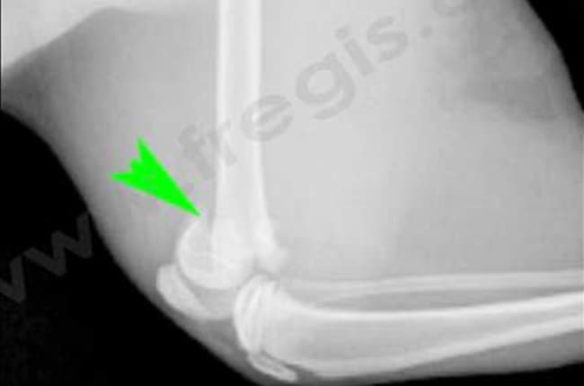 Fractures pédiatriques (ou fractures de type Salter Harris) chez le chat