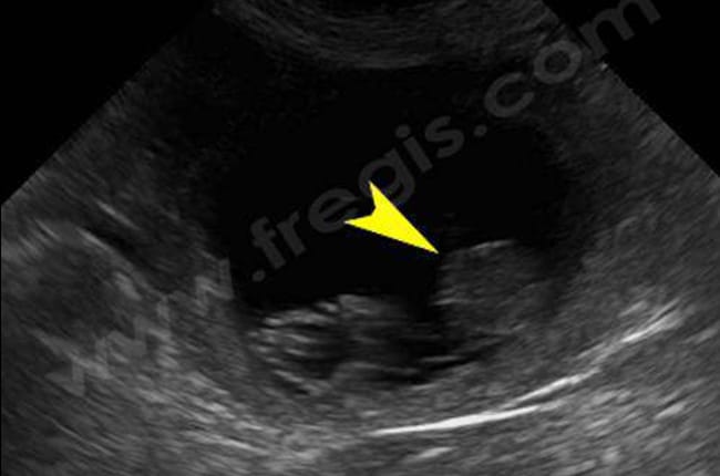 Gestation (Grossesse) chez le chienne