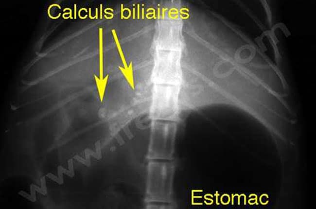 Calculs biliaires (cholélithiase) chez le chat