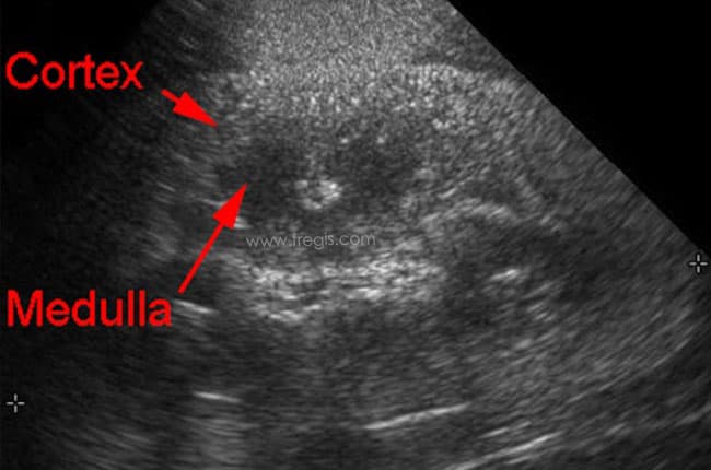 Hématurie rénale idiopathique chez le chien