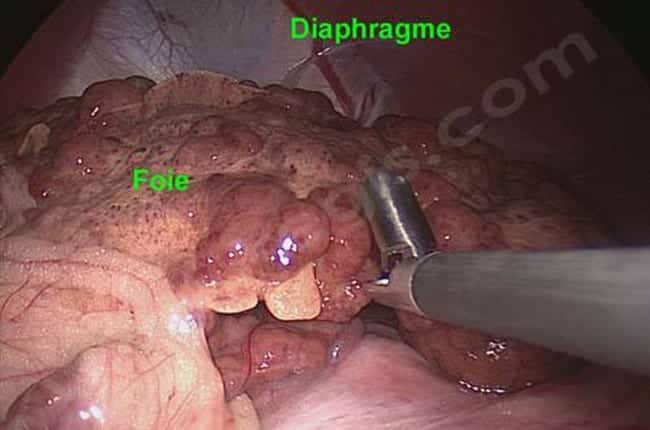 Hepatite lobulaire chez le chien