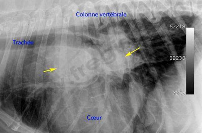 Histiocytome ou sarcome histiocytaire chez le chien