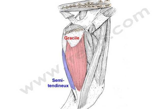 Myopathie fibrosante du semi-tendineux chez le chien