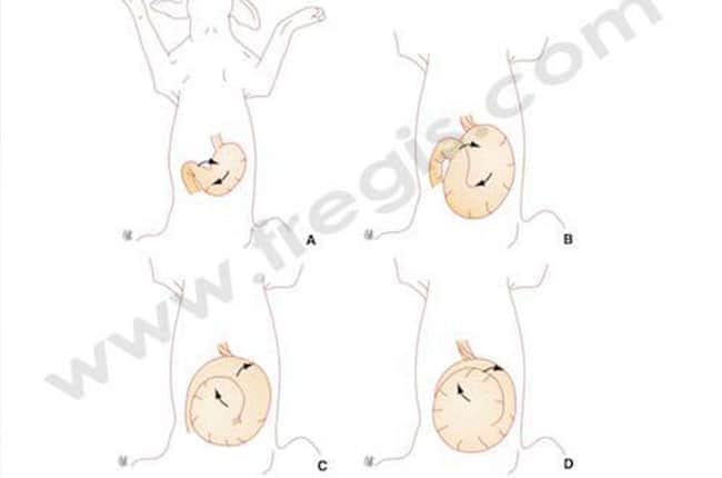 Syndrome de dilatation torsion de l'estomac chez le chien
